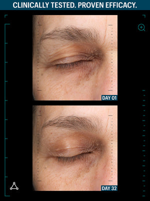 OVERNIGHT FIRMING DUO