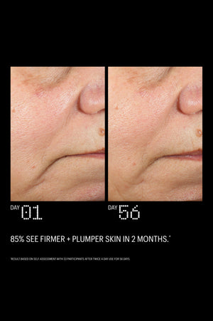 Before and after: firmer, plumper skin after 56 days, 85% saw results