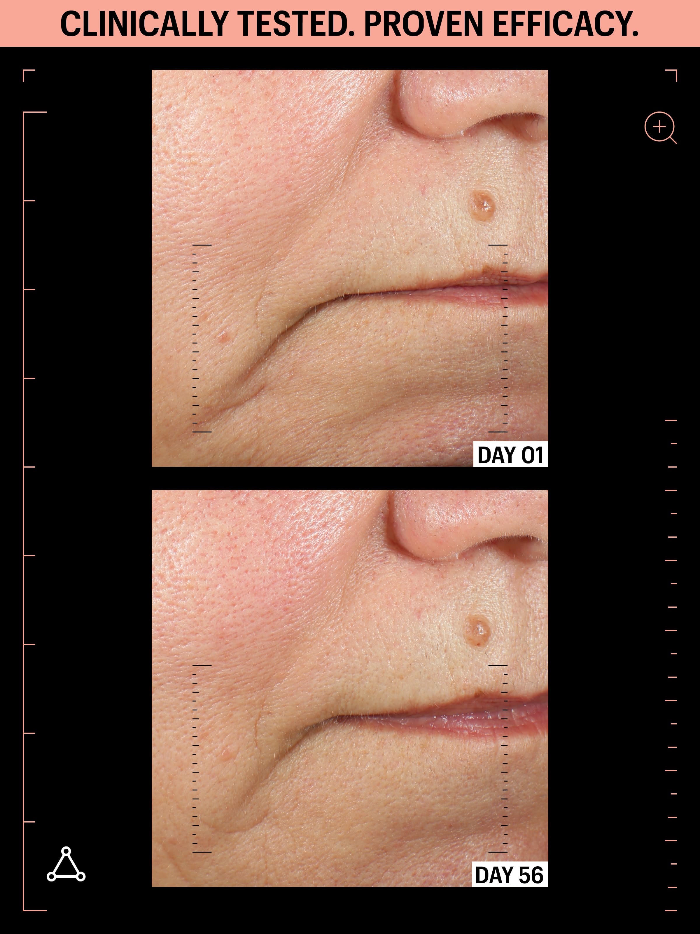 allies of skin moisturisers with peptides before after