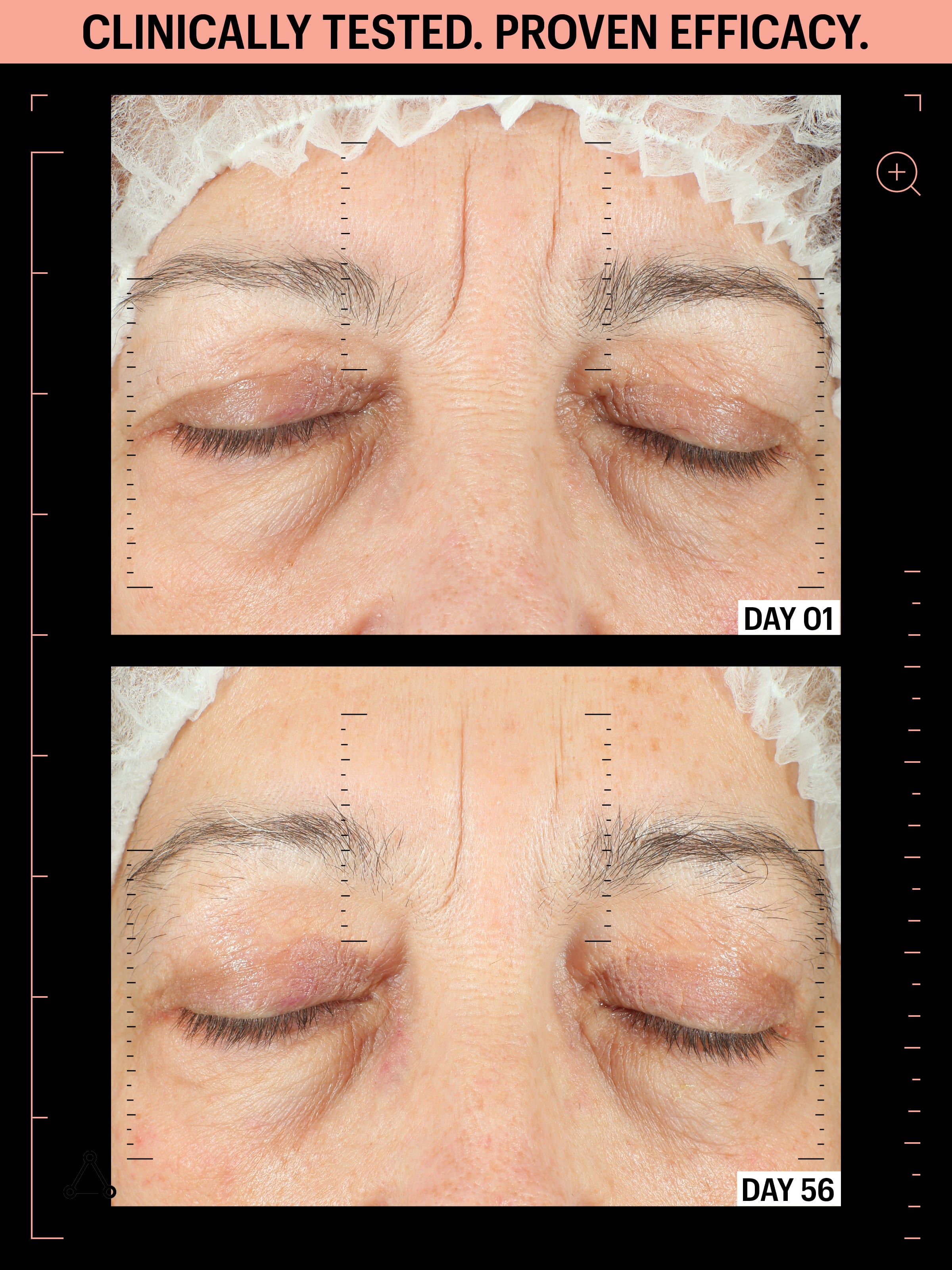 allies of skin peptides before after