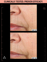 allies skin antioxidants for skin before after