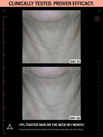 allies of skin antioxidants skincare before after