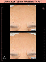 antioxidants firming daily treatment before after