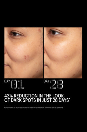 Before and after: 43% fewer dark spots after 28 days