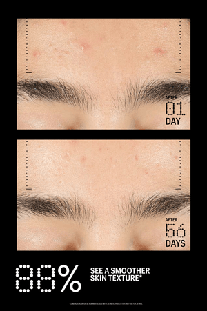 Azelaic & Kojic Advanced Clarifying Serum