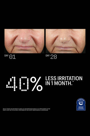 Before and after: 40% less skin irritation after 28 days