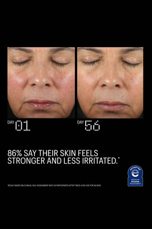 Before and after: 86% report stronger, less irritated skin