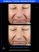 best copper peptide serum before after