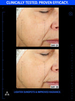 sunspots serum before after