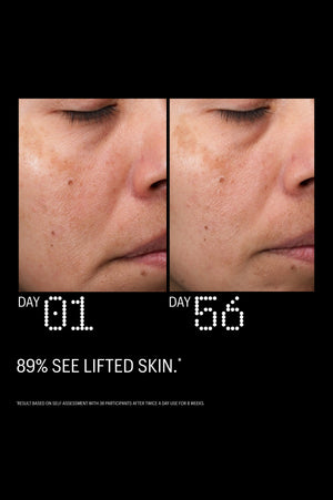 Before and after: lifted skin after 56 days of use