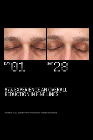 Before and after: fewer fine lines around closed eyes after 28 days