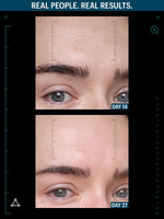 Multi GF Serum before after