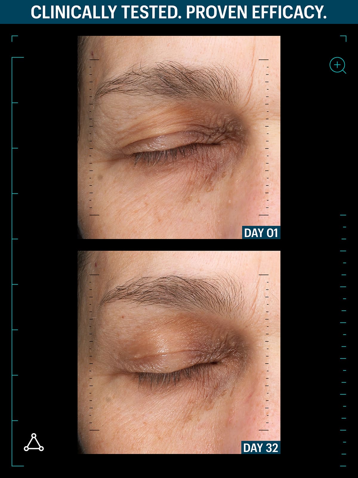 Growth factor peptides before after