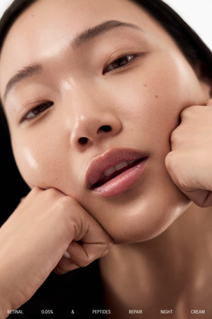 Model resting chin on hands, showing smooth, radiant skin