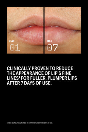 Before and after: fuller, plumper lips after 7 days of Peptint use