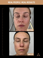 allies of skin sunscreen before after